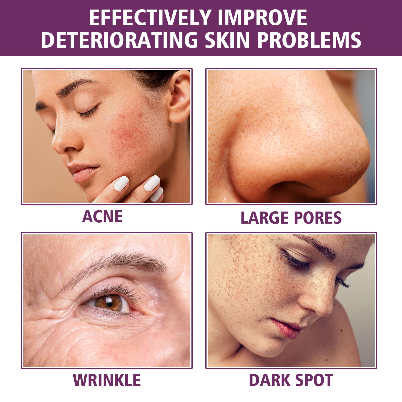 Niacinamide Essence for Facial Skin Care